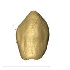 KB5163 Paranthropus robustus LRC labial