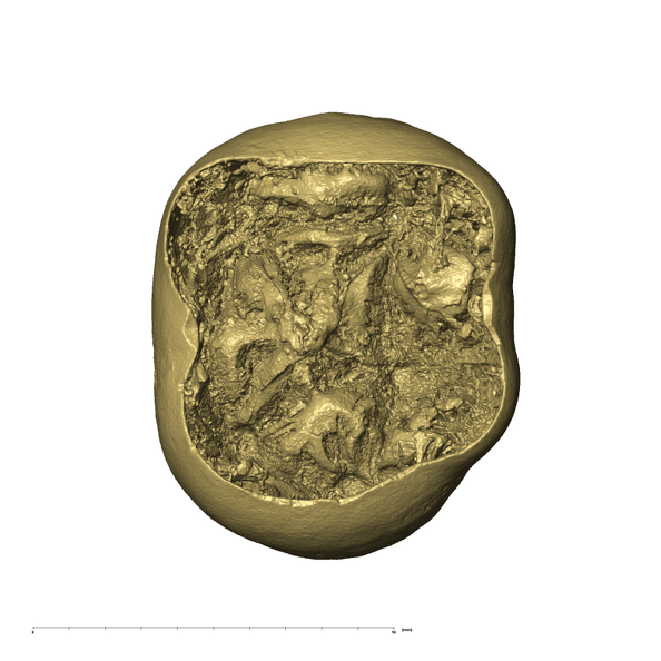 KB5223 Paranthropus robustus LLDM2 apical