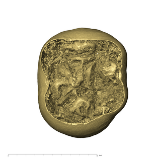KB5223 Paranthropus robustus LLDM2 apical