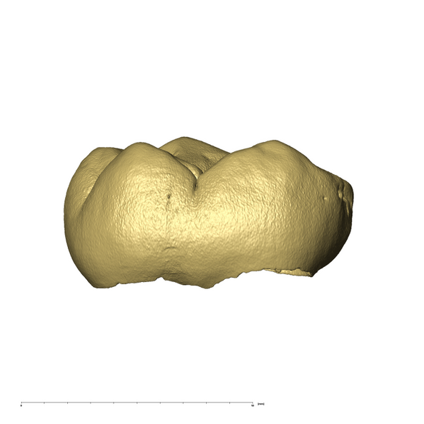 KB5223 Paranthropus robustus LLDM2 lingual