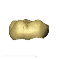 KB5223 Paranthropus robustus LLDM2 lingual