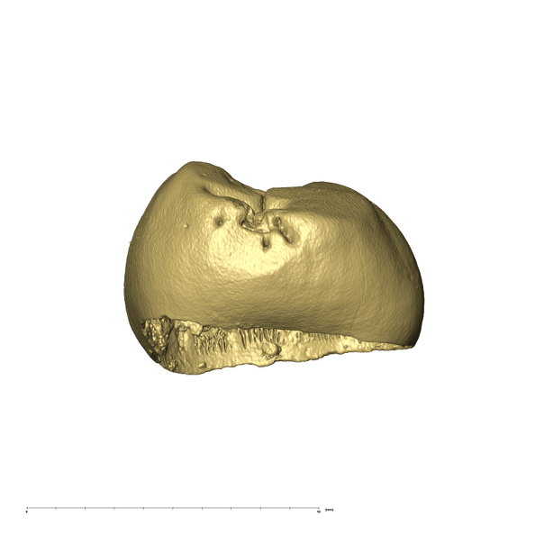 KB5223 Paranthropus robustus LLDM2 mesial