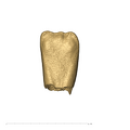 KB5223 Paranthropus robustus LRI1 lingual