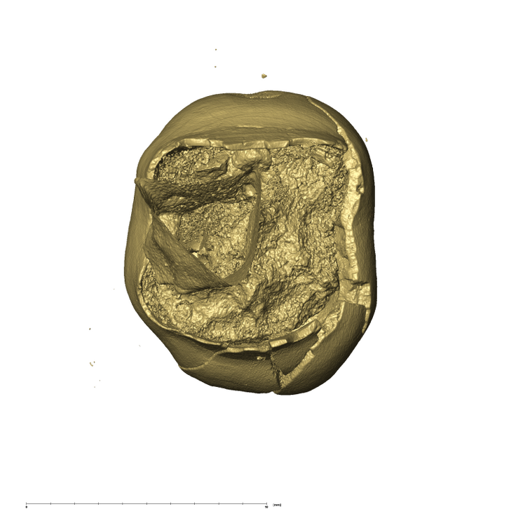 KB5503 Paranthropus robustus LRDM2 apical