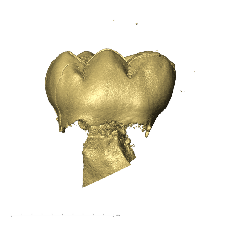 KB5503 Paranthropus robustus LRDM2 buccal
