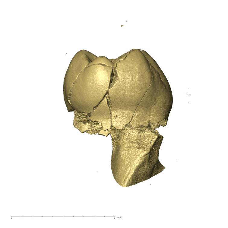 KB5503 Paranthropus robustus LRDM2 distal