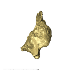 TM1517a Paranthropus robustus cranium front