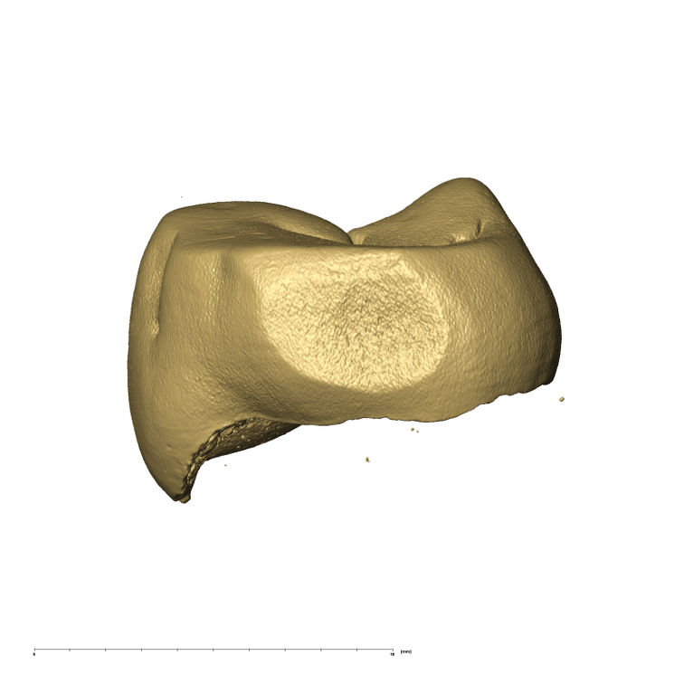 TM1517c Paranthropus robustus LLP3 distal