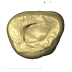 TM1517c Paranthropus robustus URM3 apical