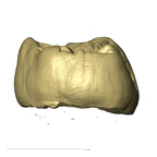 TM1517c Paranthropus robustus URM3 distal