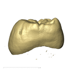 TM1517c Paranthropus robustus URM3 mesial