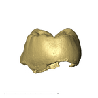 TM1601d Paranthropus robustus LLP4 mesial