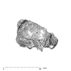 SKW 18 Paranthropus robustus partial cranium anterior
