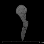 SKW 18 Paranthropus robustus right malleus internal