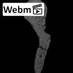 SKW 18 Paranthropus robustus right malleus ct stack movie