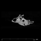 SKW 18 Paranthropus robustus right petrous internal