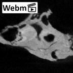 SKW 18 Paranthropus robustus right petrous ct stack movie