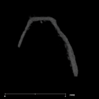 SKW 18 Paranthropus robustus right stapes Part 1 internal