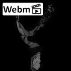 SKW 18 Paranthropus robustus right temporal ct stack movie