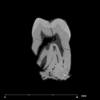 SKW 33 Paranthropus robustus URM2 internal