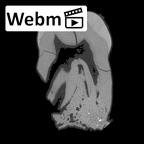SKW 33 Paranthropus robustus URM2 ct stack movie