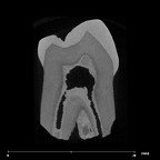 SK 100 Paranthropus robustus LRP3 internal