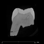 SK 102 Paranthropus robustus ULM1 internal