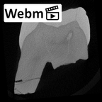 SK 102 Paranthropus robustus ULM1 ct stack movie