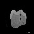 SK 104 Paranthropus robustus LRM1 internal
