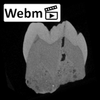 SK 104 Paranthropus robustus LRM1 ct stack movie