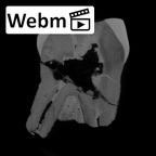 SK 14001 Paranthropus robustus ULP3 ct stack movie