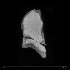 SK 14024 Paranthropus robustus femoral head internal