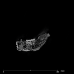 SK 1586 Paranthropus robustus mandible internal