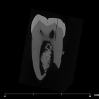 SK 1587b Paranthropus robustus LRM2 internal