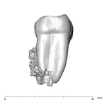 SK 1587b Paranthropus robustus LRM2 mesial