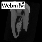 SK 1587b Paranthropus robustus LRM2 ct stack movie