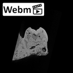 SK 1589 Paranthropus robustus URP4 ct stack movie