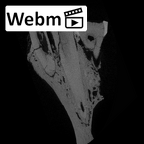 SK 1590b Paranthropus robustus partial right maxilla ct stack movie