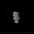 SK 1590e Paranthropus robustus bone fragment 1 internal