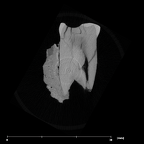 SK 1593 Paranthropus robustus LRP3 internal