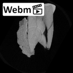 SK 1593 Paranthropus robustus LRP3 ct stack movie