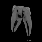 SK 17 Paranthropus robustus URM1 internal