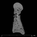 SK 1813 Paranthropus robustus first right metatarsal internal