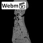 SK 1813 Paranthropus robustus first right metatarsal ct stack movie