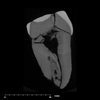 SK 18a Hominin LLP3 internal