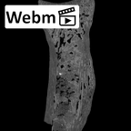 SK 18b Hominin left radius ct stack movie