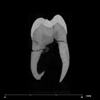 SK 1 Paranthropus robustus LLM2 internal