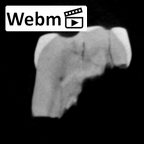 SK 21a Paranthropus robustus ULM3 ct stack movie