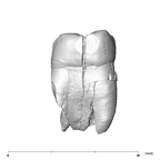 SK 22 Paranthropus robustus LRM3 mesial