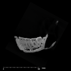 SK 23 Paranthropus robustus mandible internal